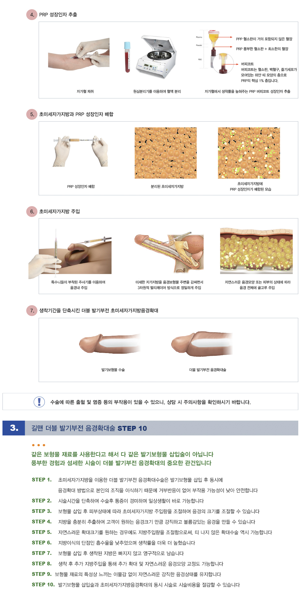 더블 발기부전음경확대